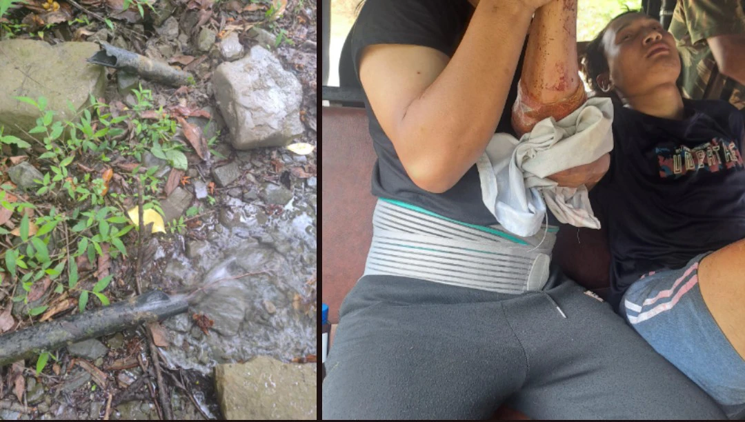 Cut off water pipe and Injured Konsakhul villager